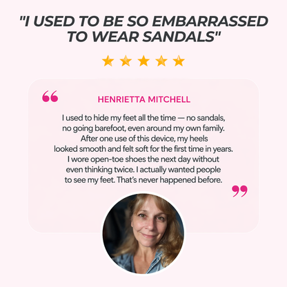 SilkySole - Callus Remover Pro