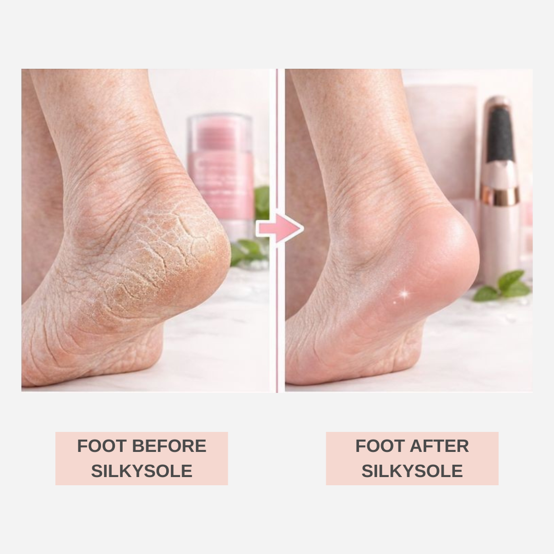 SilkySole Complete Heel Repair System
