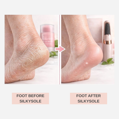SilkySole Complete Heel Repair System