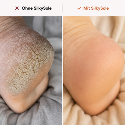 SilkySole | Hornhautentferner Pro