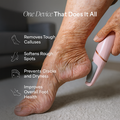 SilkySole - Callus Remover Pro